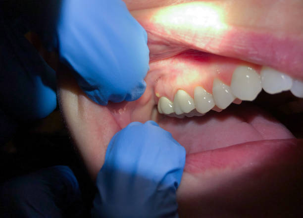 Best Emergency Dentist for Knocked-Out Tooth in Erwin, TN