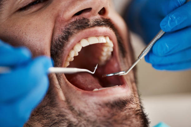 Best Broken or Cracked Tooth Emergency Dentist in Erwin, TN