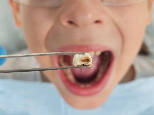 Best Emergency Dental Services for Seniors in Erwin, TN